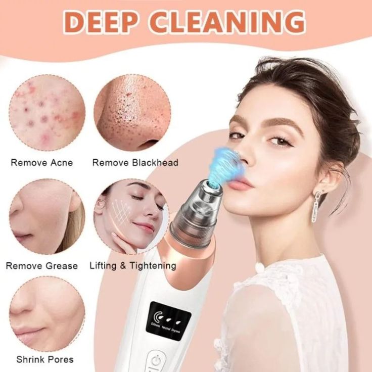 Korazi™ Precision Blackhead Remover Vacuum – Rechargeable Pore Cleaner with Multi-Level Suction & Extraction Kit